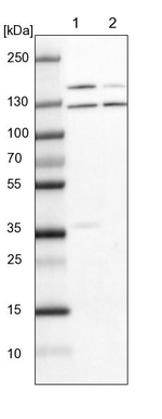 DHX38 Antibody in Western Blot (WB)