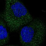 TELO2 Polyclonal Antibody