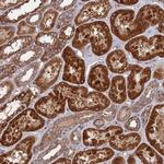 TELO2 Antibody in Immunohistochemistry (Paraffin) (IHC (P))