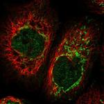 CIAPIN1 Polyclonal Antibody