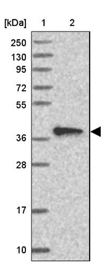 CIAPIN1 Antibody in Western Blot (WB)