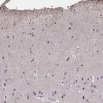 CACNG8 Antibody in Immunohistochemistry (IHC)