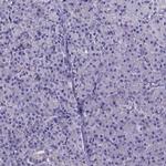 CACNG8 Antibody in Immunohistochemistry (IHC)