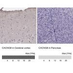 CACNG8 Antibody