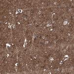 NMRAL1 Antibody in Immunohistochemistry (Paraffin) (IHC (P))