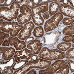 NMRAL1 Antibody in Immunohistochemistry (Paraffin) (IHC (P))