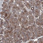 NMRAL1 Antibody in Immunohistochemistry (Paraffin) (IHC (P))