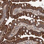 NMRAL1 Antibody in Immunohistochemistry (Paraffin) (IHC (P))