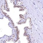 FLYWCH2 Antibody in Immunohistochemistry (Paraffin) (IHC (P))