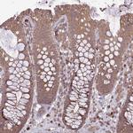 TIGD7 Antibody in Immunohistochemistry (IHC)