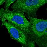 ZNF2 Polyclonal Antibody