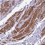 ZNF2 Antibody in Immunohistochemistry (Paraffin) (IHC (P))