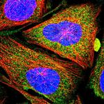 CCBE1 Polyclonal Antibody