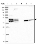 TMOD2 Antibody in Western Blot (WB)