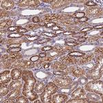 TRMT1 Polyclonal Antibody