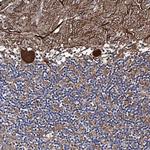 PTCD3 Antibody in Immunohistochemistry (Paraffin) (IHC (P))