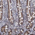 PTCD3 Antibody in Immunohistochemistry (Paraffin) (IHC (P))