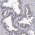 PTCD3 Antibody in Immunohistochemistry (Paraffin) (IHC (P))