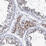PTCD3 Antibody in Immunohistochemistry (Paraffin) (IHC (P))