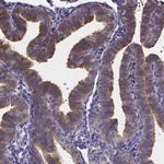 RERG Antibody in Immunohistochemistry (Paraffin) (IHC (P))