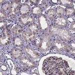 RERG Antibody in Immunohistochemistry (Paraffin) (IHC (P))