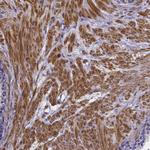 RERG Polyclonal Antibody