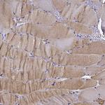 RERG Antibody in Immunohistochemistry (Paraffin) (IHC (P))
