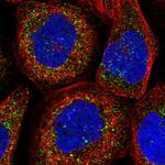 TXNDC11 Polyclonal Antibody