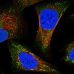 IVD Polyclonal Antibody