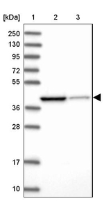IVD Antibody in Western Blot (WB)