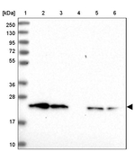 ATP Synthase O Antibody in Western Blot (WB)
