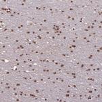 CDKN2AIP Antibody in Immunohistochemistry (Paraffin) (IHC (P))