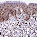 CDKN2AIP Antibody in Immunohistochemistry (Paraffin) (IHC (P))