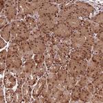 CDKN2AIP Antibody in Immunohistochemistry (Paraffin) (IHC (P))