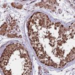 CDKN2AIP Polyclonal Antibody