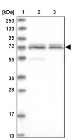 CDKN2AIP Antibody in Western Blot (WB)