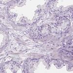 CABCOCO1 Antibody in Immunohistochemistry (IHC)