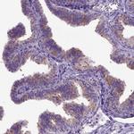 NEK5 Antibody in Immunohistochemistry (IHC)