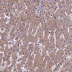PZP Antibody in Immunohistochemistry (Paraffin) (IHC (P))