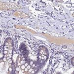 PZP Antibody in Immunohistochemistry (Paraffin) (IHC (P))