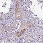 PZP Antibody in Immunohistochemistry (Paraffin) (IHC (P))