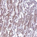 ANKS3 Antibody in Immunohistochemistry (Paraffin) (IHC (P))