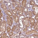 ANKS3 Antibody in Immunohistochemistry (Paraffin) (IHC (P))