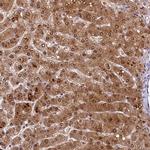 ANKS3 Antibody in Immunohistochemistry (Paraffin) (IHC (P))