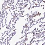 ANKS3 Antibody in Immunohistochemistry (Paraffin) (IHC (P))