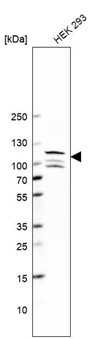 ANKS3 Antibody in Western Blot (WB)