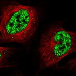 SRRM2 Polyclonal Antibody