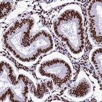 SRRM2 Antibody in Immunohistochemistry (IHC)