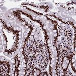 SRRM2 Antibody in Immunohistochemistry (IHC)
