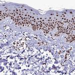 SRRM2 Antibody in Immunohistochemistry (IHC)